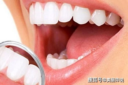 為什么要洗牙 掌握洗牙知識保衛(wèi)口腔健康